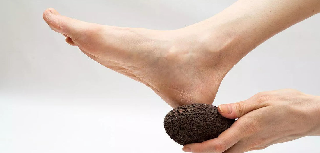 Los beneficios del Aceite de Cacay para las durezas