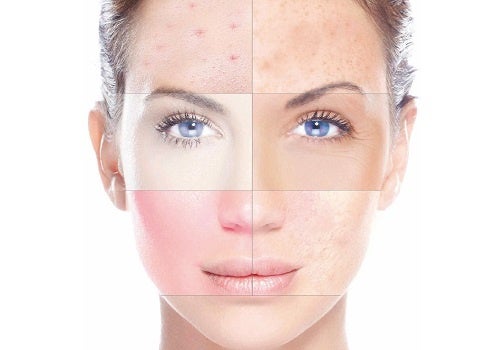 Aprende a cuidar tu piel